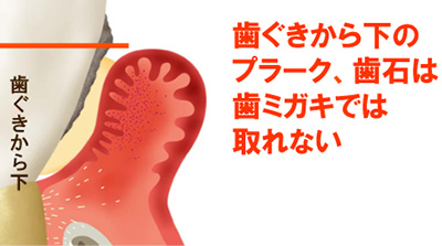 プロフェッショナルケア