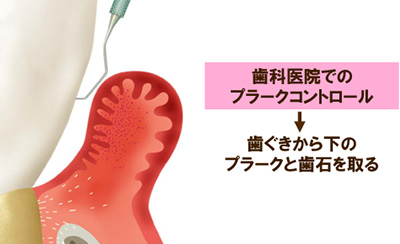 プロフェッショナルケア